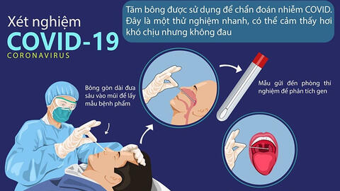 Giá dịch vụ xét nghiệm COVID-19 được công khai
