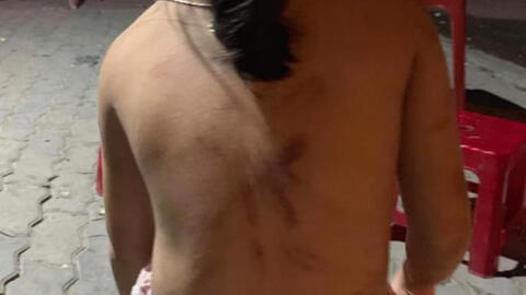 Cháu bé bị bà cố nội đánh đập  dã man