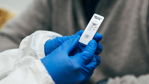 Tại sao vạch test nhanh Covid-19 có lúc mờ lúc nhạt?