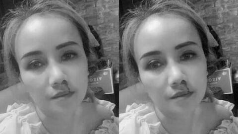 Công an vào cuộc vụ nữ diễn viên Hoàng Yến bị chồng cũ đánh gãy mũi