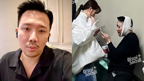 Trấn Thành đăng ảnh cận mặt, tiết lộ 1 điểm thay đổi giữa nghi vấn sang Hàn phẫu thuật thẩm mỹ?