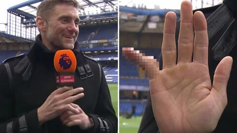 Sau khi chơi gần 700 trận, cựu thủ môn gây ngỡ ngàng khi tiết lộ hình ảnh ngón tay út