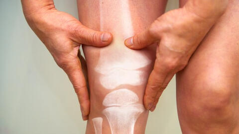 6 dấu hiệu trên cơ thể cảnh báo ung thư xương đã “gõ cửa”: Người trẻ càng phải đề phòng