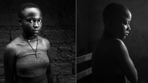 Bàng hoàng những người mẹ dùng chày nung nóng để ủi ngực con gái vì lo sợ quấy rối tình dục