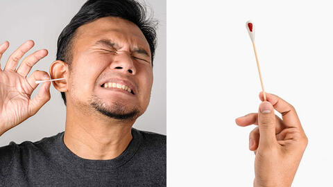 Màu sắc ráy tai nói lên tình trạng sức khỏe của bạn?