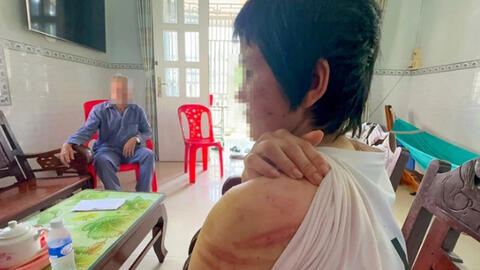 Vụ người phụ nữ tố chồng bạo hành ở Hải Dương: Các cấp Hội phụ nữ vào cuộc