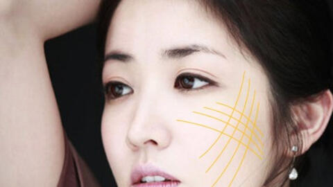 Vì sao căng da mặt có thể gây chết người?