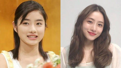 4 thói quen khiến khuôn mặt ngày càng to tròn, cái đầu nhiều người mắc nhất