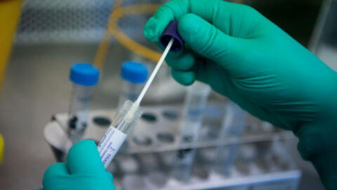 WHO chính thức chấp thuận bộ kit xét nghiệm COVID-19 của Việt Nam