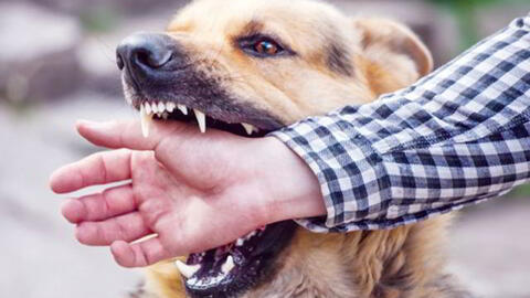 Bé 5 tuổi ở Quảng Trị tử vong sau 1 tháng bị chó thả rông cắn