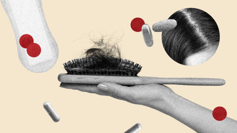 BS da liễu và BS phụ khoa giải thích lý do tại sao kinh nguyệt ra nhiều lại ảnh hưởng đến mái tóc của chị em