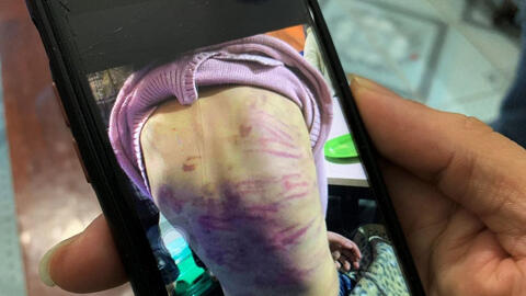 Bé gái 12 tuổi bị mẹ bạo hành, bạn trai của mẹ xâm hại tình dục