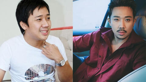 Trấn Thành từng thừa nhận "dao kéo" 1 điểm trên gương mặt, khẳng định: "Đẹp nhân tạo còn hơn xấu tự nhiên"