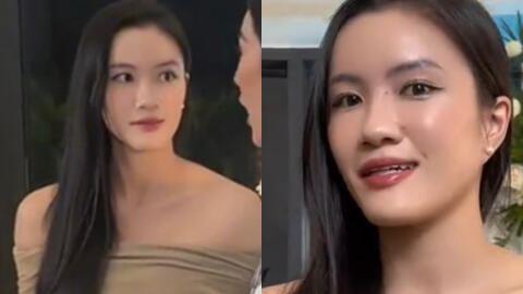 Á hậu Vbiz bị soi nhan sắc khác lạ qua "cam thường" khi lộ diện hậu xác nhận phẫu thuật thẩm mỹ