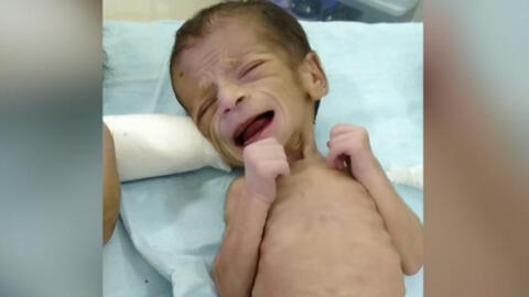 Bé gái sơ sinh bị chôn sống tại Ấn Độ được giải cứu