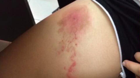 Chuyên gia cảnh báo bệnh nhiễm ký sinh trùng do thói quen nuôi thú cưng