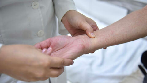 Hà Nội ghi nhận số ca mắc sốt xuất huyết tăng hơn 4 lần so với năm 2021