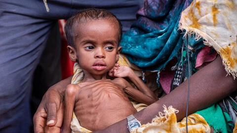 Chiến tranh ở Ukraina làm cho nạn đói ở Somalia trở nên tồi tệ hơn