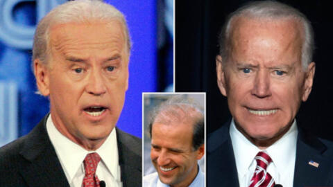 Bằng chứng cho thấy Ông Joe Biden phẫu thuật thẩm mỹ để "níu kéo tuổi xuân"