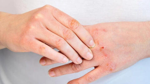 Nhiều người Hà Nội phải đi viện vì giữa mùa hè lại bị "bệnh mùa đông"