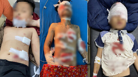 Tuyên Quang: 4 học sinh bị thương nặng khi dùng máy xay sinh tố để trộn hóa chất