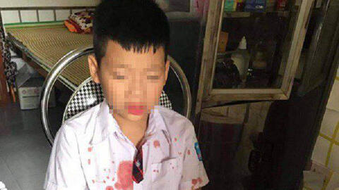 Khởi tố người đàn ông hành hung dã man bé trai lớp 1