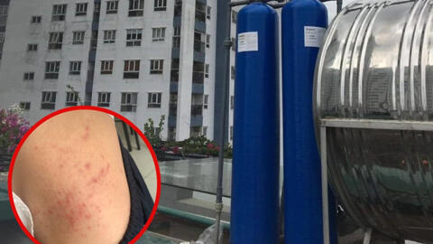 Hàng trăm hộ dân chung cư ở Hà Nội yêu cầu làm rõ nguồn nước sạch gây mẩn ngứa