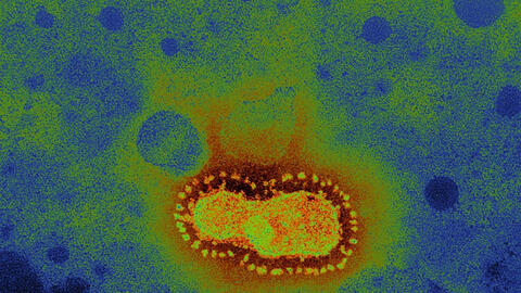 Coronavirus - 'Nỗi sợ của những điều chưa biết' và những tia sáng hi vọng