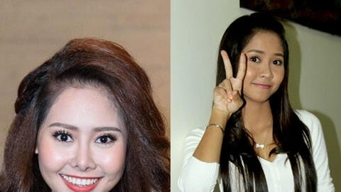 Diễn viên Tường Vi lần đầu lên tiếng về "thảm hoạ sửa mũi"