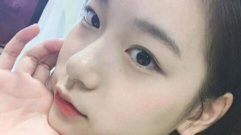 Bác sĩ chia sẻ 5 dấu hiệu cảnh báo bệnh gan có thể thấy ngay trên khuôn mặt