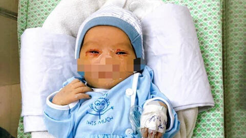 Bé sơ sinh bị bỏ rơi nghi bị nhiễm trùng máu