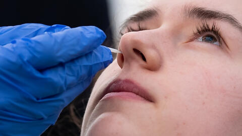 Nghiên cứu mới phát hiện 2 dấu hiệu sớm và phổ biến của Covid-19