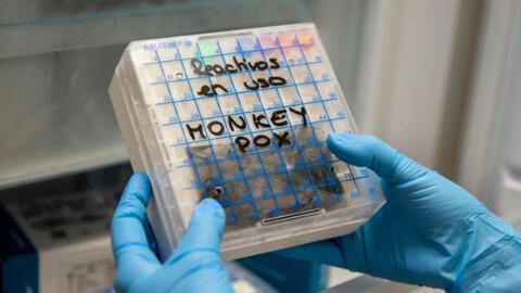 WHO họp khẩn, cân nhắc việc tuyên bố dịch đậu mùa khỉ có phải là tình trạng khẩn cấp toàn cầu hay không