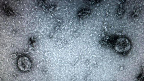 Việt Nam đã nuôi cấy và phân lập thành công virus corona mới