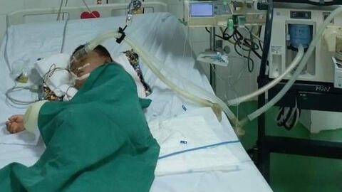 Bé trai 4 tuổi chọc phá tổ ong, bị đốt hơn 80 mũi