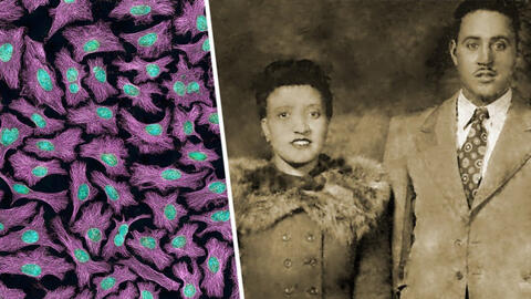 Henrietta Lacks: Người phụ nữ da màu tạo đột phá trong cuộc chiến chống ung thư cổ tử cung
