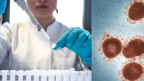 Chuyên gia nêu lý do đậu mùa khỉ không có khả năng gây ra một đại dịch như SARS-CoV-2