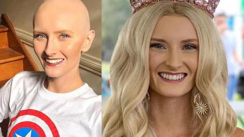 Tân Hoa hậu Trái Đất Australia 2020 và hành trình chiến thắng ung thư não