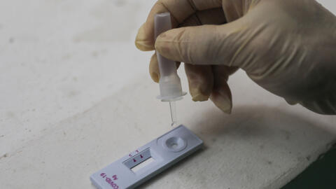 Dung dịch kit test Covid-19 bị cảnh báo nhiễm độc, chuyên gia Việt Nam nói gì?