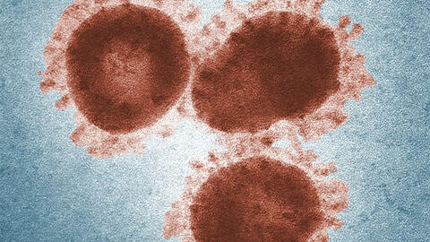 Công ty rao bán âm thanh của COVID-19