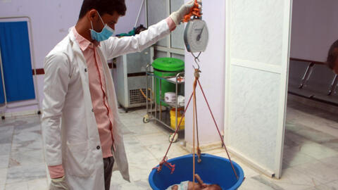 Yemen rơi vào nghèo đói nghiêm trọng sau khi bị cắt viện trợ nhân đạo