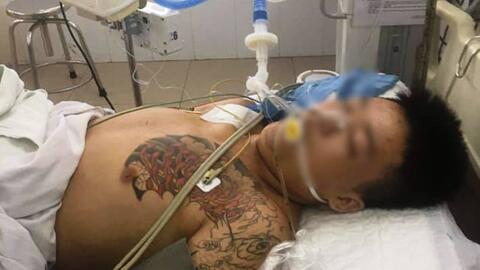 Người nhà tố nghi phạm bị đánh trong trại tạm giam, công an nói gì?