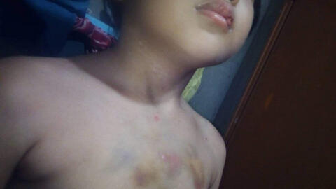 Lời khai của cặp vợ chồng hờ nghiện ma túy, bạo hành con gái 6 tuổi như thời Trung cổ