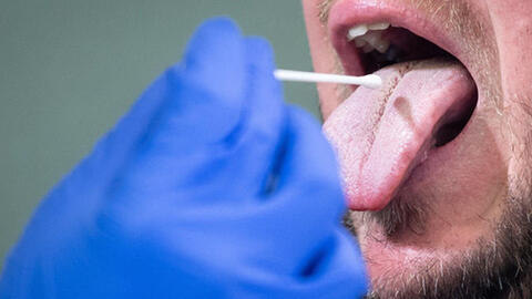 Nghiên cứu mới: Dùng điện thoại để xét nghiệm Covid-19 với giá chỉ 7 USD