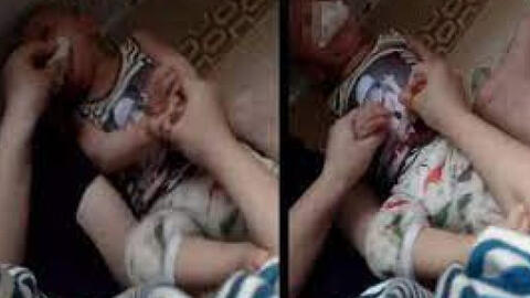 Bộ GD-ĐT yêu cầu xác minh, xử lý nghiêm việc bé trai 11 tháng tuổi bị nhét giẻ vào miệng