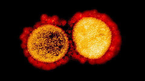 Bệnh nhân thu nhỏ kích cỡ ‘của quý’ sau khi bị nhiễm Covid-19