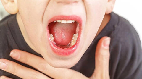 Bệnh bạch hầu trở lại: Làm thế nào để nhận biết và phòng tránh hiệu quả?