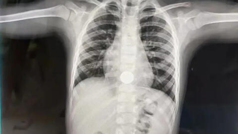 "Con kể mẹ nghe 1 bí mật" - Bà mẹ toát mồ hôi sau lời nói của đứa trẻ 3 tuổi, vội đưa con đi cấp cứu ngay trong đêm