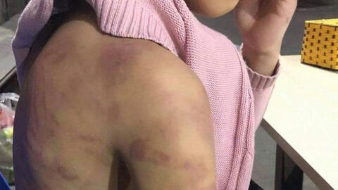 Nghi án bé gái 12 tuổi bị mẹ ruột và người tình bạo hành dã man