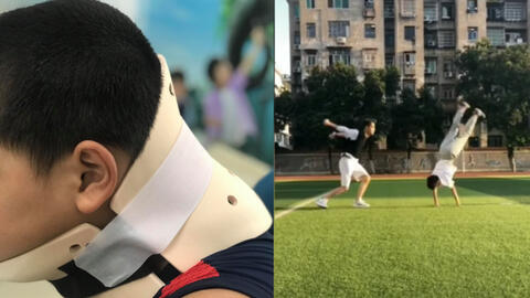 Bé trai 10 tuổi bị vẹo cổ vì học theo trò nhào lộn trên Tik Tok